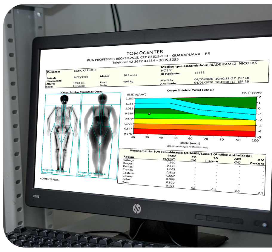 Densitometria de Composição Corporal