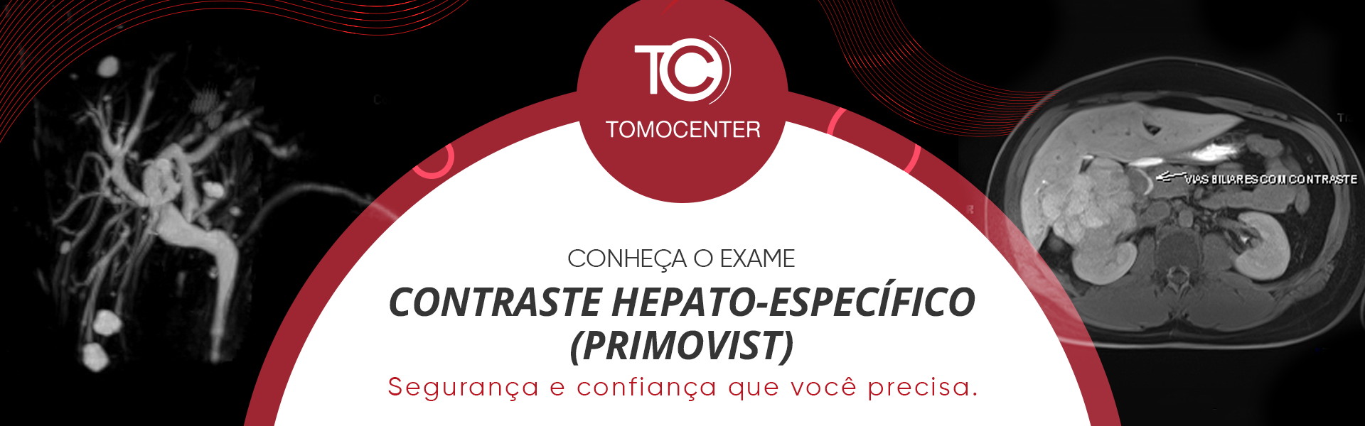 Primeira clínica de Tomografia Computadorizada e Ressonância Magnética do  Oeste do Paraná, a Unitom recebeu o Selo de Qualidade Unimed na categoria  Ouro.